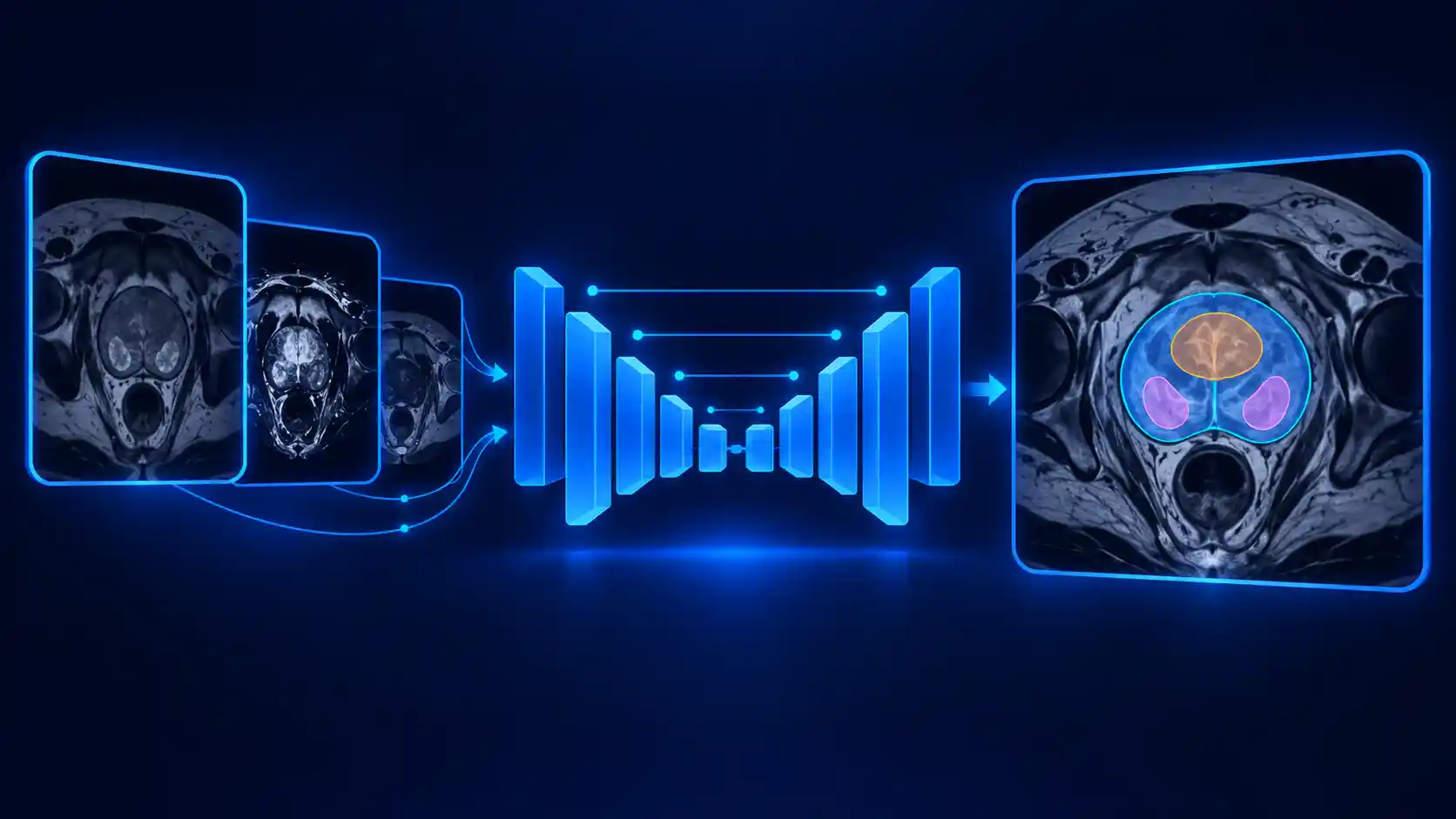 بخش‌بندی خودکار پروستات و ساختارهای داخلی آن در تصاویر MRI با استفاده از شبکه U Net و تلفیق تصاویر چندوجهی